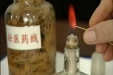 【明秀分院特色疗法】壮医药线点灸疗法